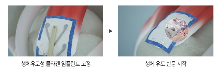 리제네텐 이미지