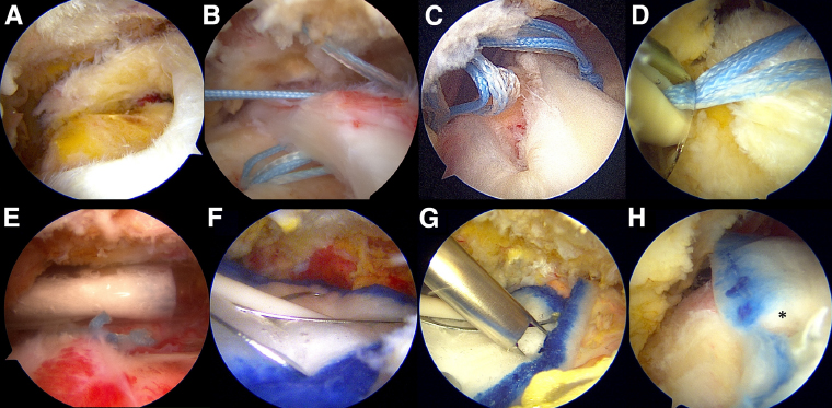 비수술 치료 이미지