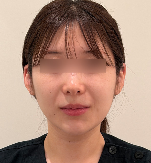 after