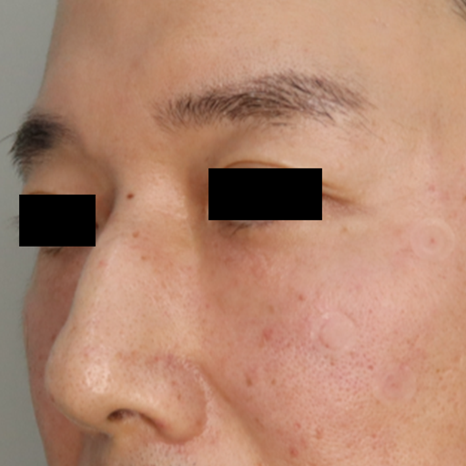 after