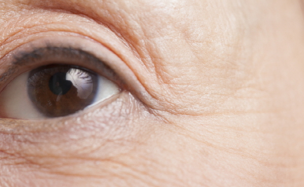 Fine Lines and Dark Circles Around the Eyes: Can Rejuran i Help? Published | Aug