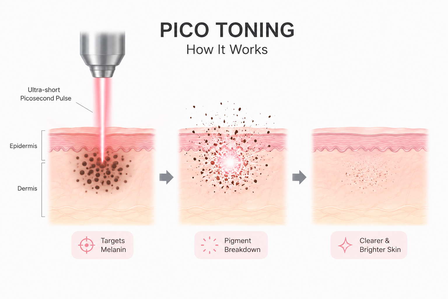 Pico Toning Results: How Many Sessions for Pigmentation? Published: August 19, 2