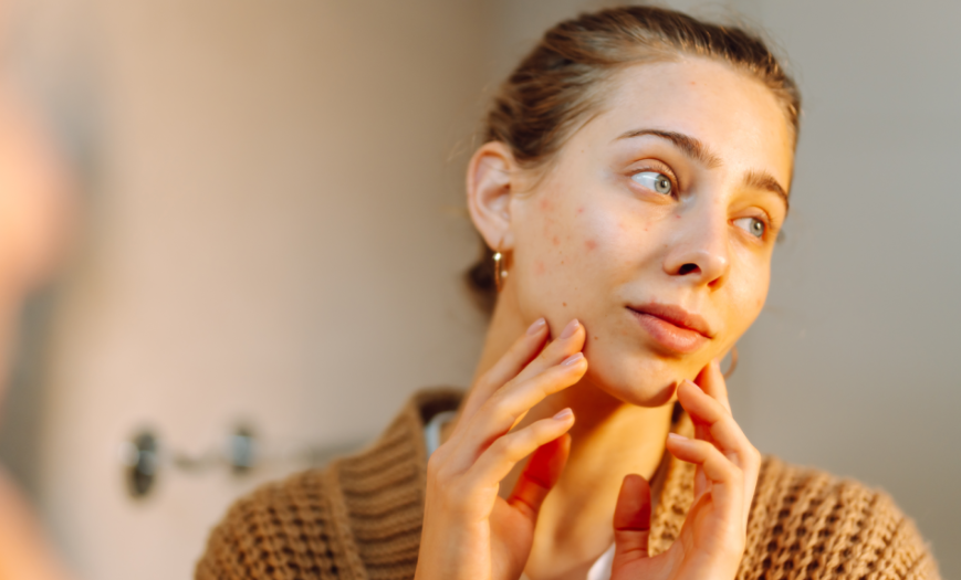 "Is Re2o the best solution for every skin type?" Hello, This is nbom Clinic. Rec