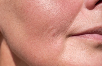 Areas Line-Type Handpieces Can’t Reach — Here’s the Solution | Pen-Type Applicat