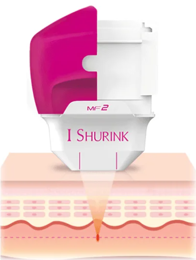 Eye Lifting with the Dedicated 'Shrink Eye' Device Hello, this is nbom Clinic. W