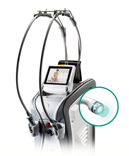 Onda Lifting: Achieving 'Firmness' from Within without Surface Damage Hello, thi