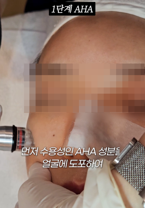 Guide to the 3-Step Aqua Peel Procedure Hello, this is nbom Clinic. Today, we wo