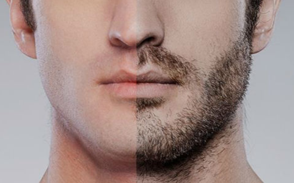 Laser Hair Removal: Why You Should Focus on the Hair Follicle Rather Than the Ha
