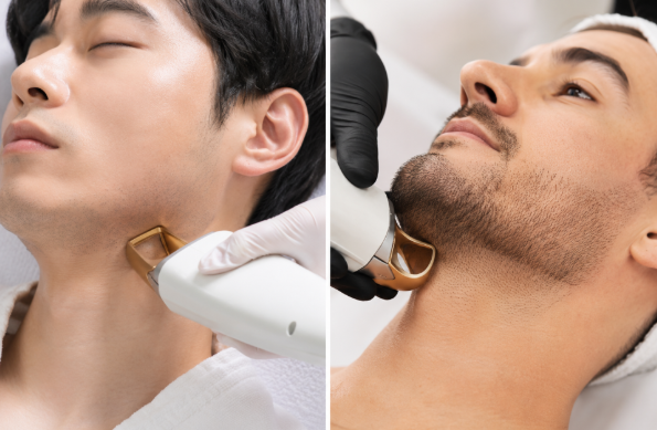 Laser Hair Removal : 'Doing it Right' is More Important Than the Laser Equipment